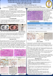 Dediff leiomyosarcoma (1)