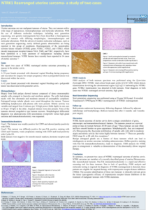 NTRK rearranged sarcoma-Sumedha V2