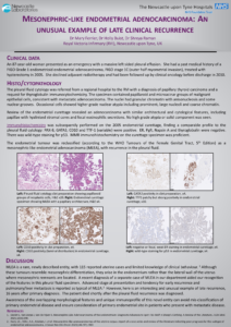 Poster MLEA an unusual example of late clinical recurrence